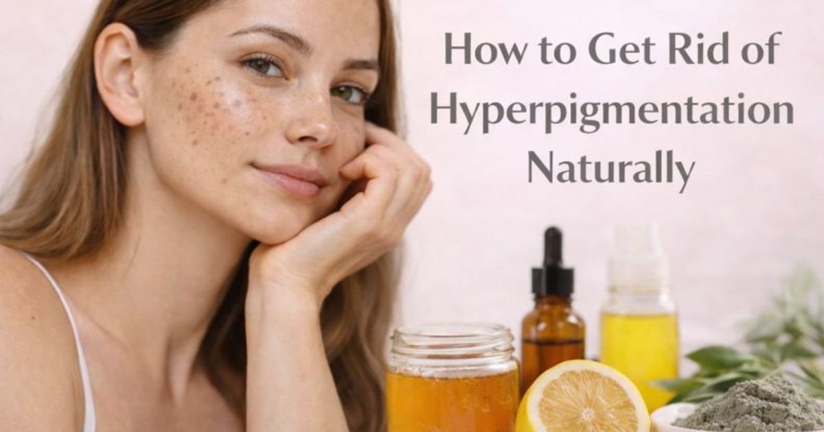 How to Get Rid of Hyperpigmentation Naturally