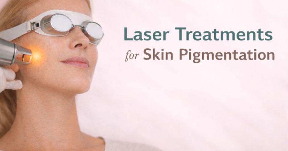 Laser Treatments for Skin Pigmentation