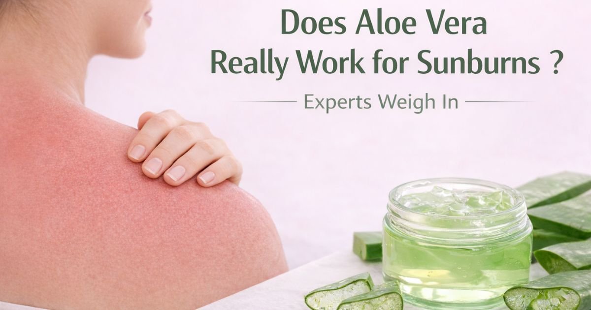 does aloe vera eally work for sunburns experts weigh in
